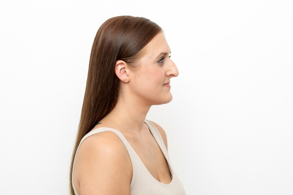 /media/upload/articles/septorhinoplastika.jpg /media/upload/articles/septorhinoplastika.jpg