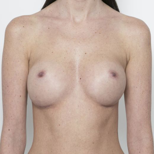 Image after
