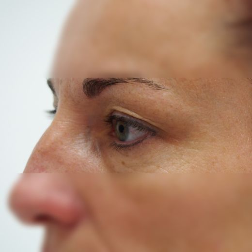 Image before