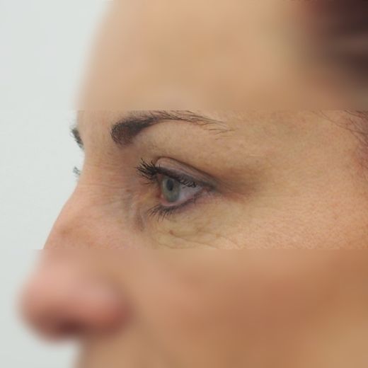 Image after