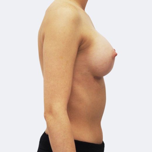 Image after