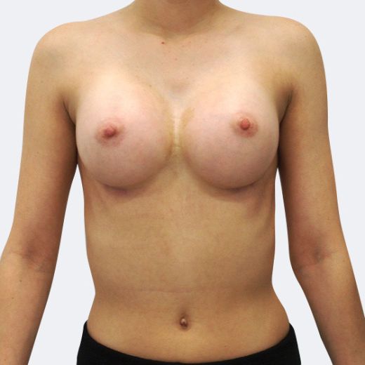Image after