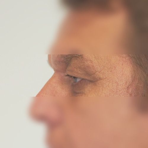 Image before