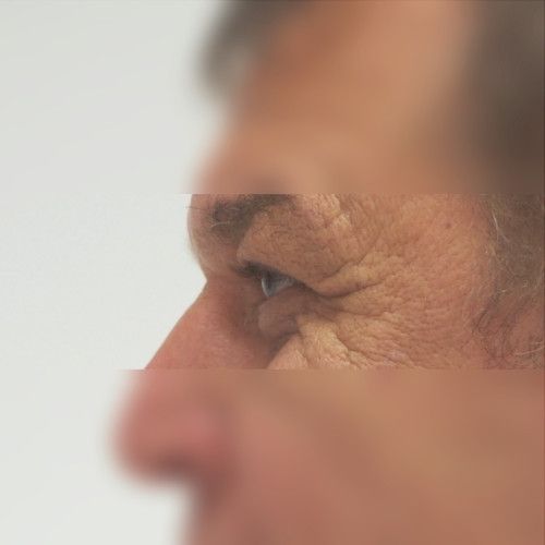 Image after
