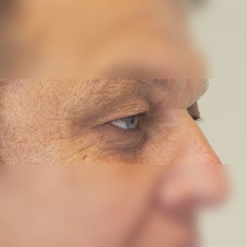 Image before