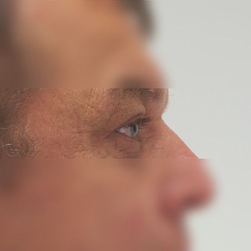 Image after