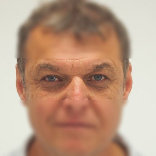 Image after