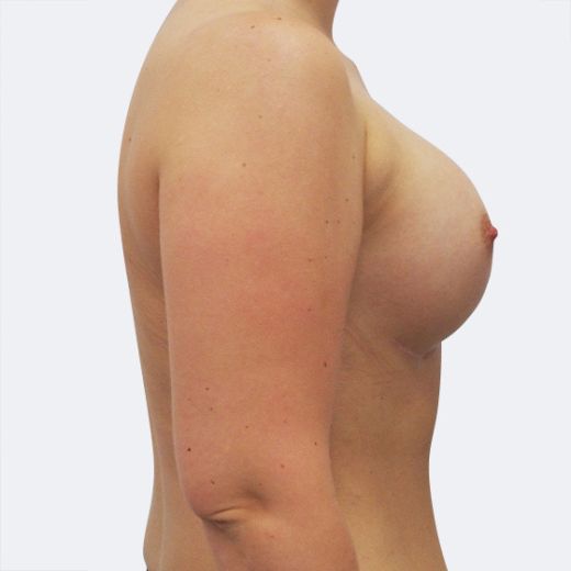 Image after