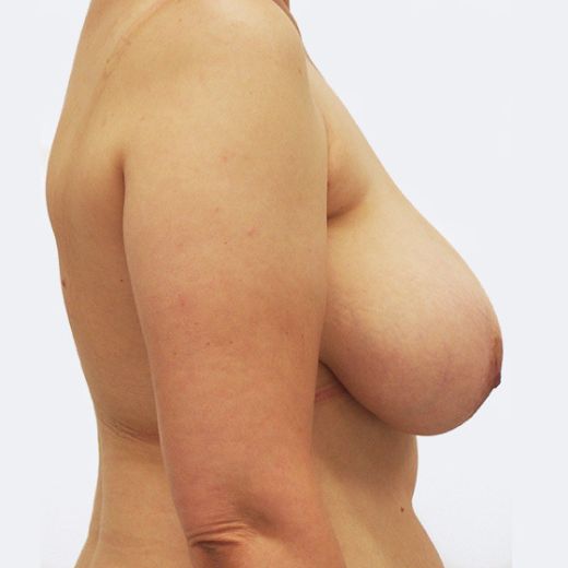 Image before