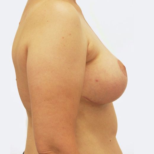Image after