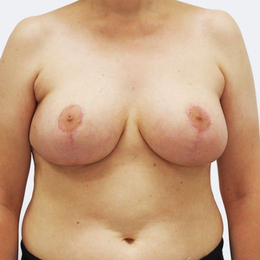 Image after