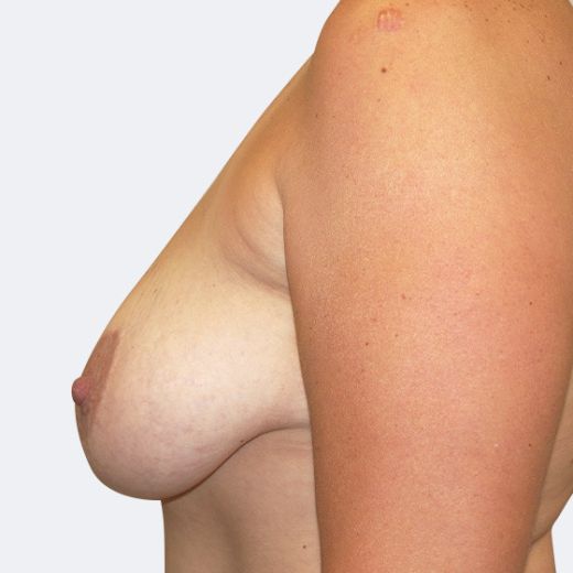 Image before