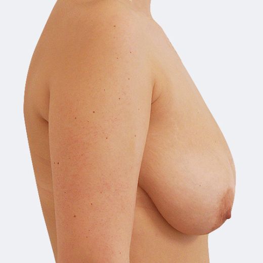 Image before