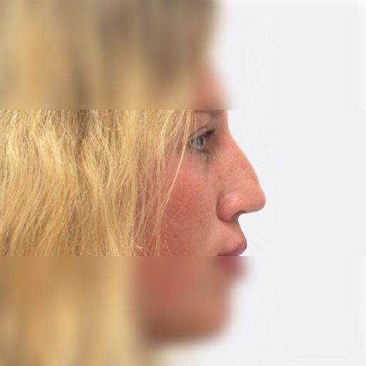 Image before