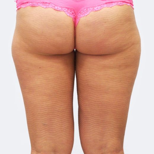 Image after