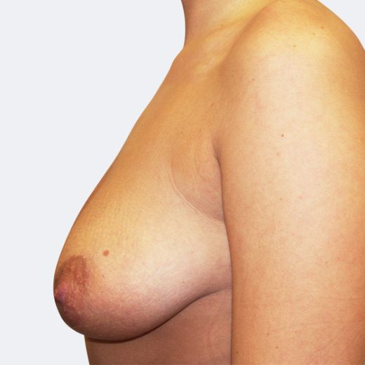 Image before