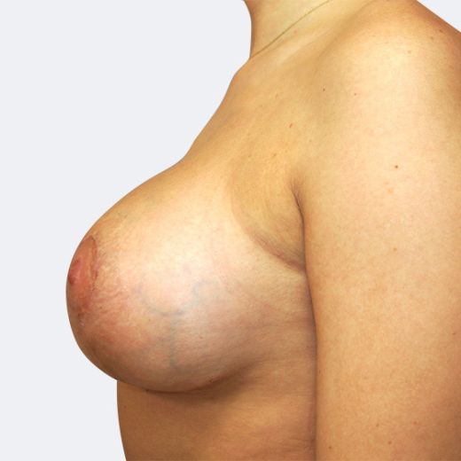 Image after