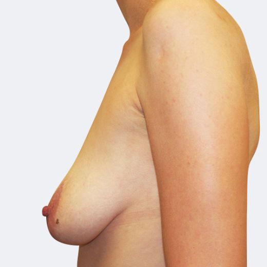 Image before