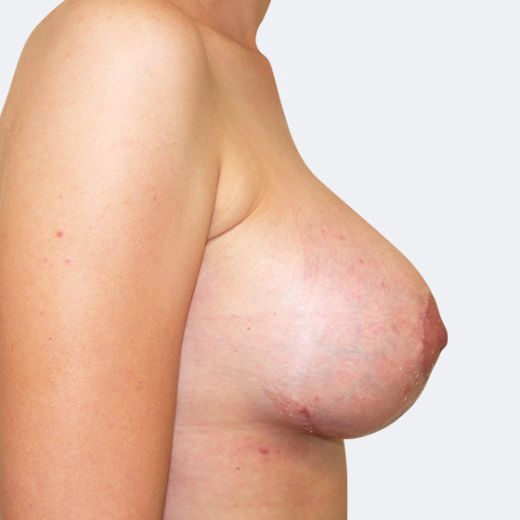 Image after