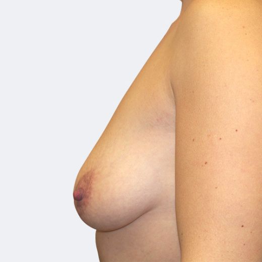 Image before
