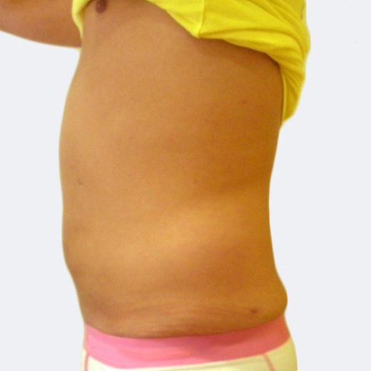 Image after