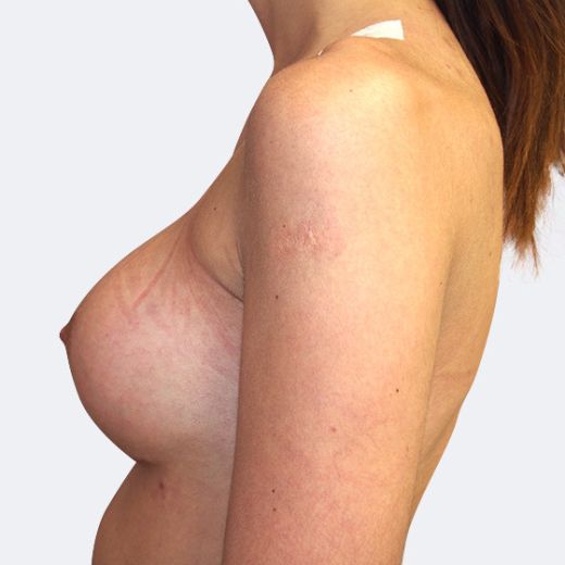 Image after