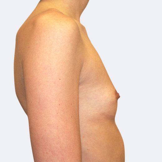 Image before