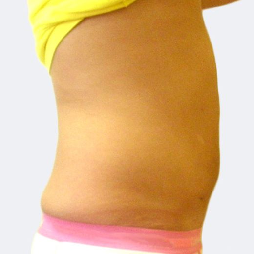 Image after