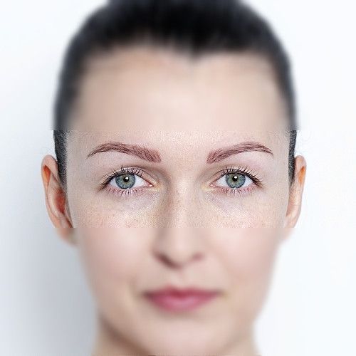 Image before