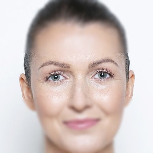 Image after