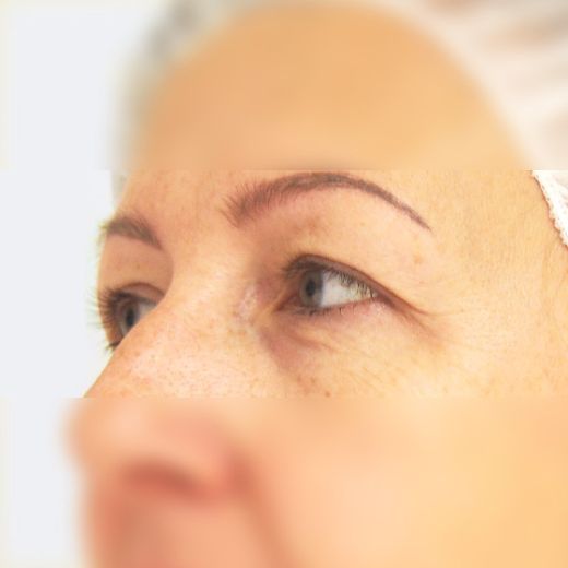 Image before