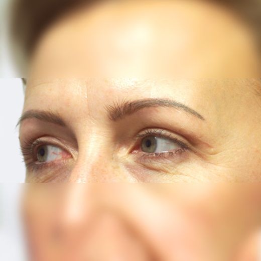 Image after