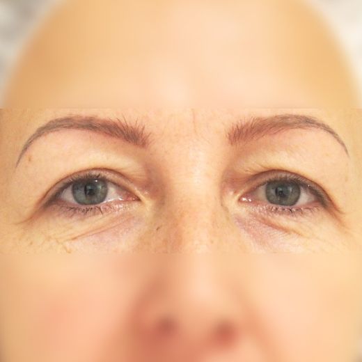Image before