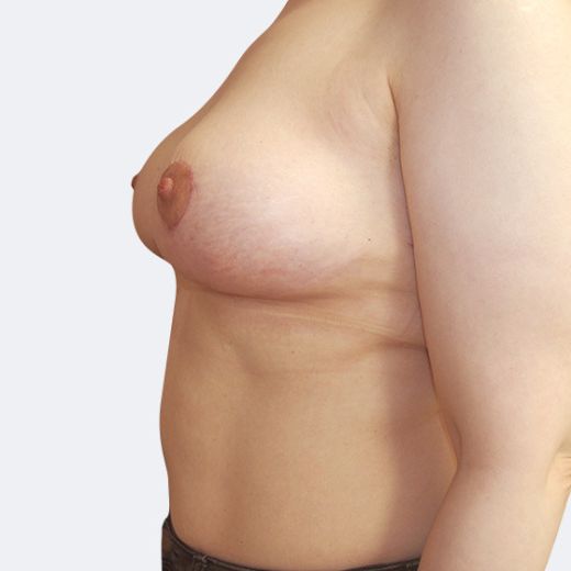 Image after