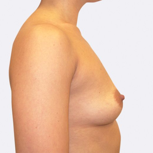 Image before