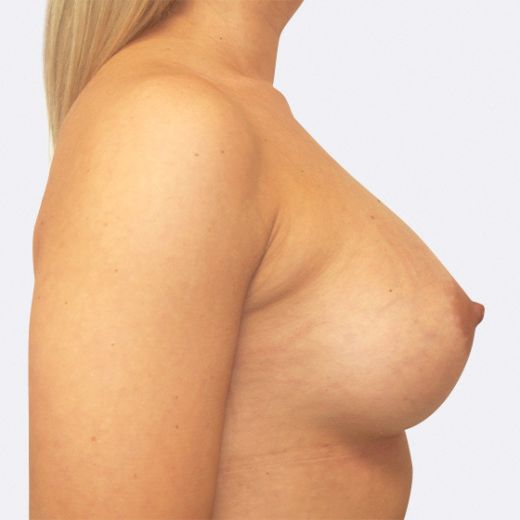Image after
