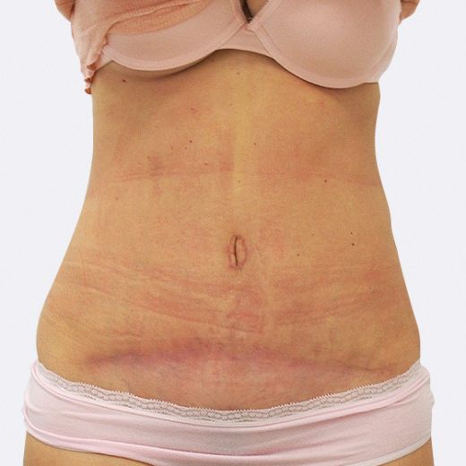 Image after