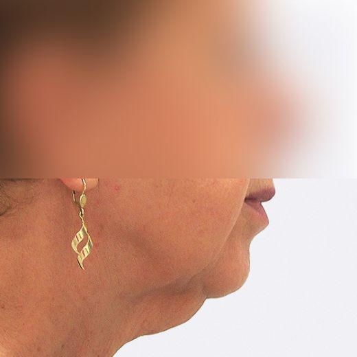 Image before