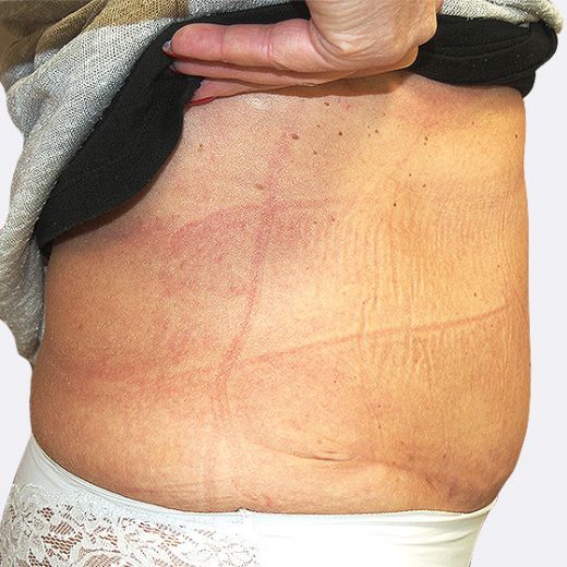 Image after
