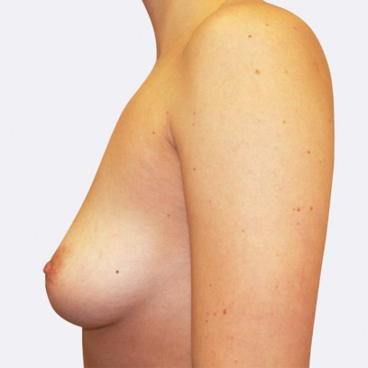 Image before