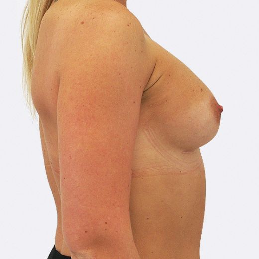 Image after