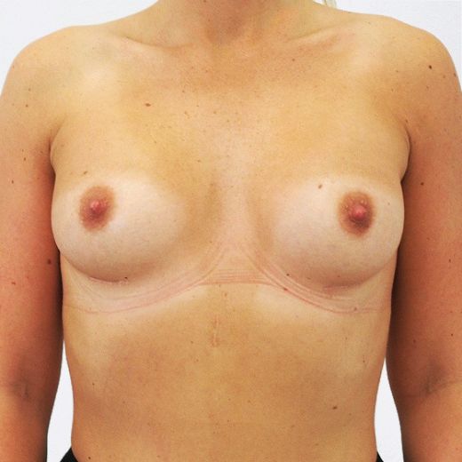 Image after