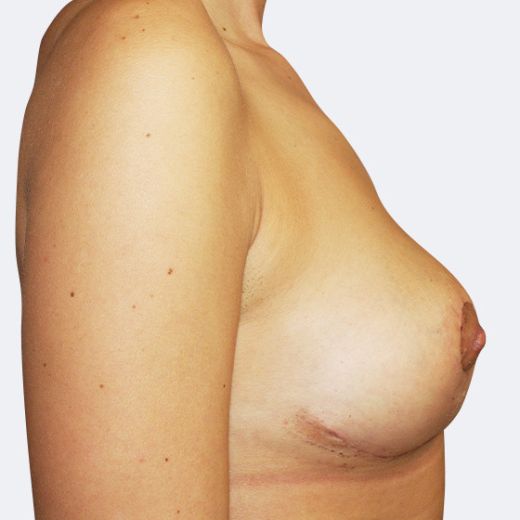Image after