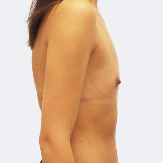 Image before