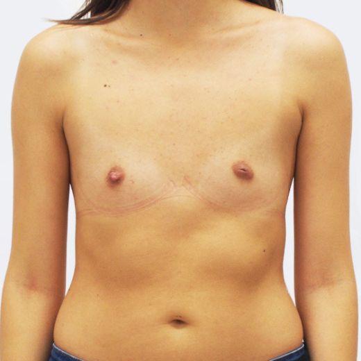 Image before