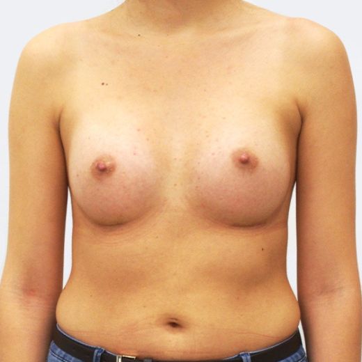 Image after