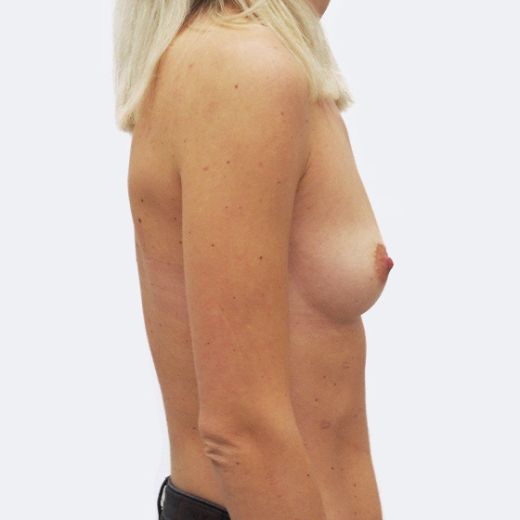 Image before