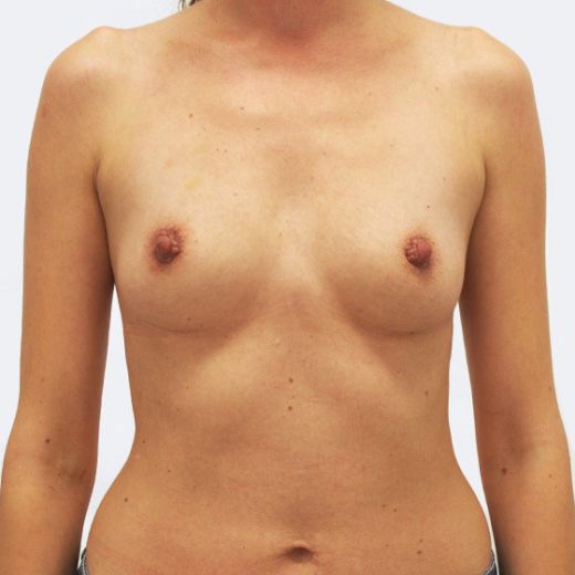 Image before