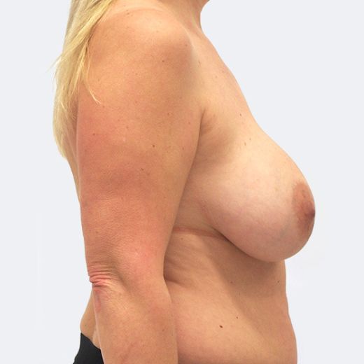 Image before