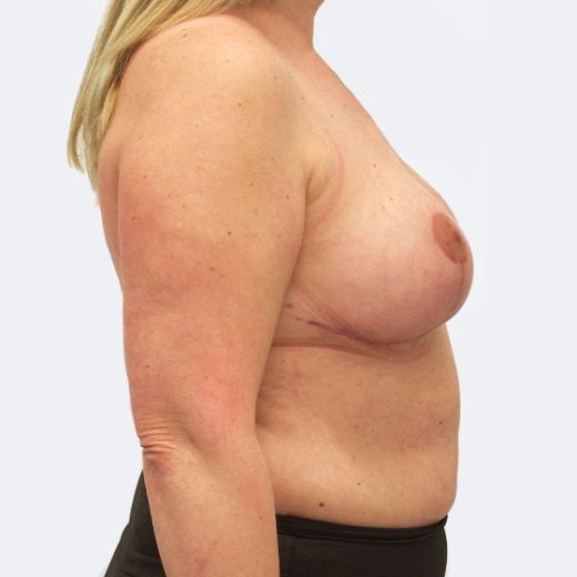 Image after